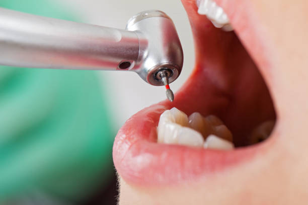 Best Emergency Gum Treatment in Uniondale, NY